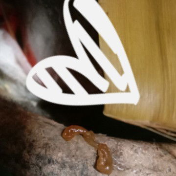 Maaf jijik ☹️ cuma mau tanya ini apa ya ? Udah bab pas mau membersihkan keraba di area vagina 😔