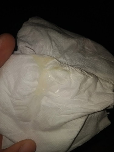 ถามแม่ๆหน่อยค่ะ