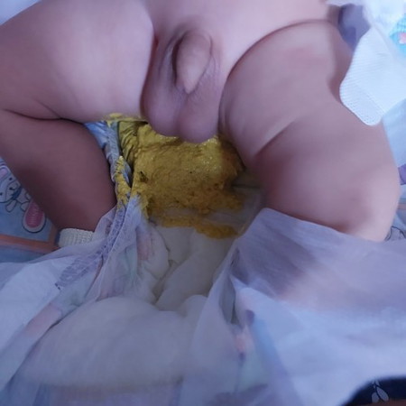 Lusaw ang poo poo mg 2 months na po baby ko.. normal lng po ba yan?