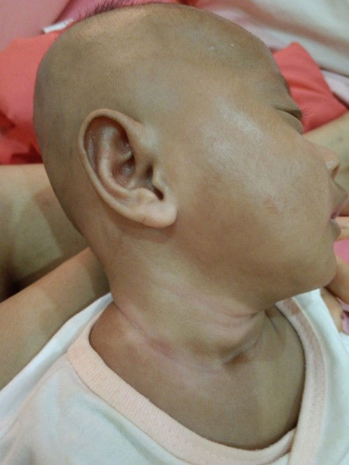 ลูกสาวผิวคล้ำมีโอกาสที่ผิวจะสว่างขึ้นกว่านี้มั้ยคะ