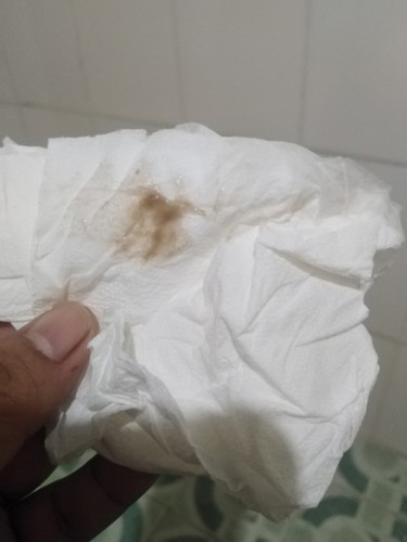 Light brown discharge at 7 weeks
