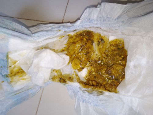 Natural lg ba to poop ni baby?