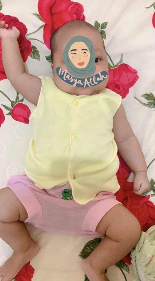 Kepala bayi datar kanan kiri