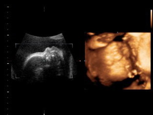 น้ำนมซึมปกติไหม