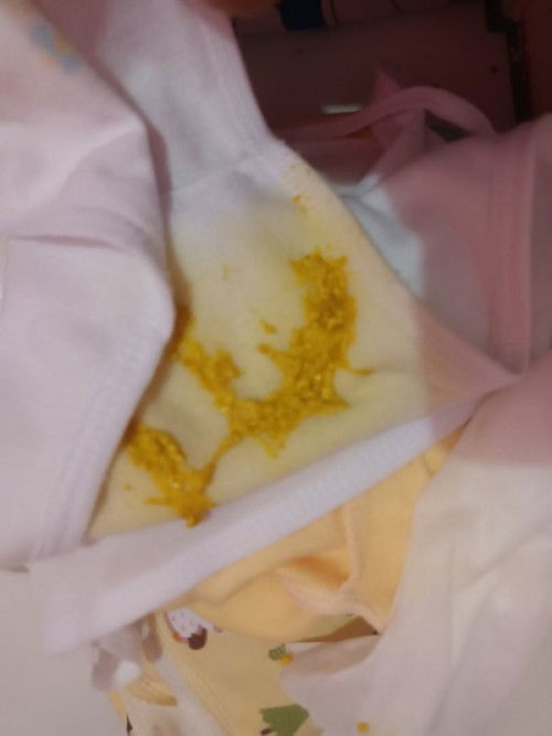 Ass maaf agak jorok .
Poop baby usia 17 hari ku kek gitu normal gak ya . ?