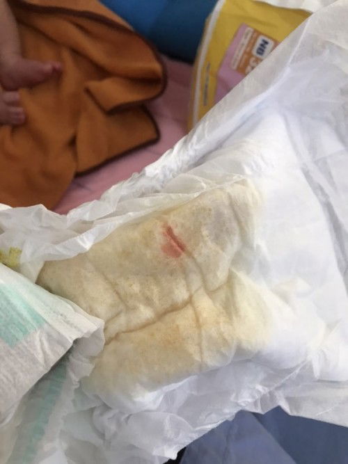 ลูกแม่ๆท่านไหนเคยเป็นบ้าง