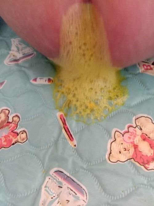 Normal poba poop Ng baby boy ko?? Pakisagot Naman po