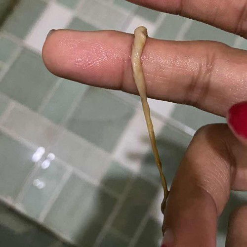 Putih2 panjang dari lubang vagina