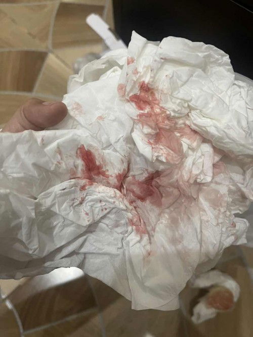 Ada yg hamil muda tp HB sama suami keluar darah?