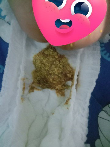 อยากสอบถามแม่ๆ