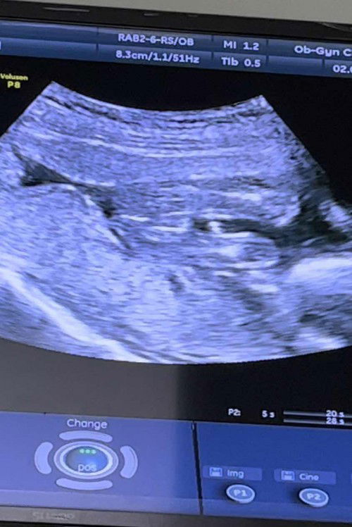 คุณแม่ช่วยดูหน่อยค่ะ ว่าเพศชายหรือเพศหญิง