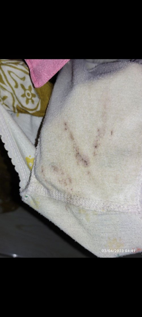 Bun ini tanda nya mau persalinan kah?