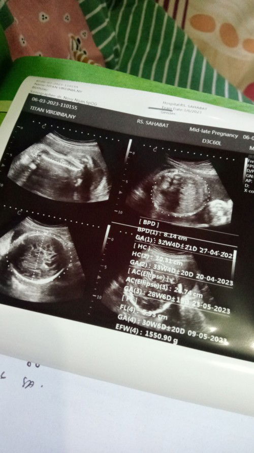 Bunda ini yang bener yang mana ya