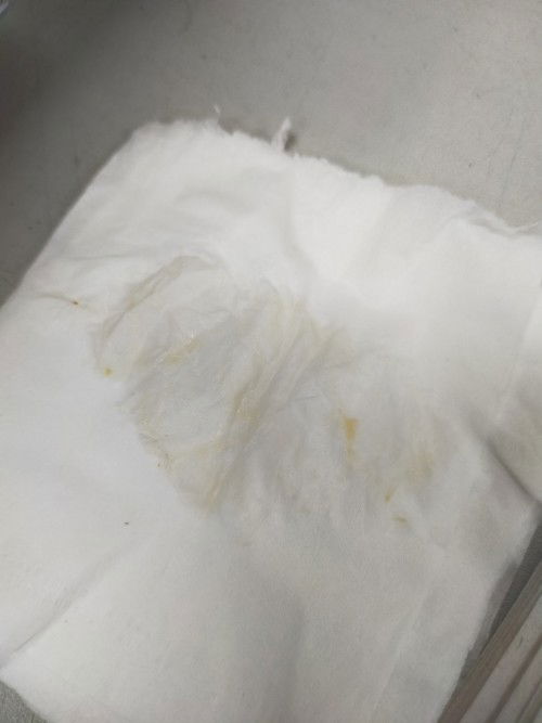 Mau nanya dong bunda2, saya kn hamil 7w nah td pagi keluar bercak Kya yg di foto itu aman g sih Bun?