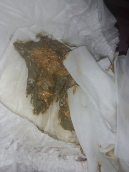 น้องถ่ายแบบนี้เป็นอะไรค่ะ