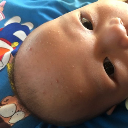 หน้าน้องเป็นอะไรขอสอบถามเเม่ๆหน่อยค่ะ