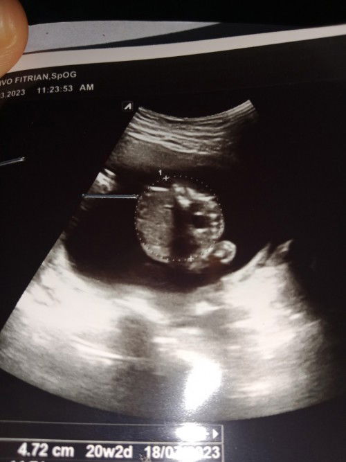 Bunda2 mau tanya apakah bunda ada yang bisa lihat jenis kelaminya cowo atau cewe klo diliat gambar