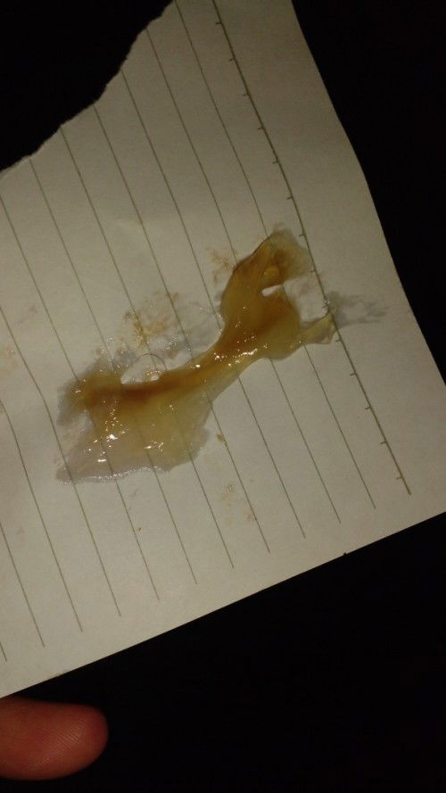 Maaf jorok. Lendir kecoklatan