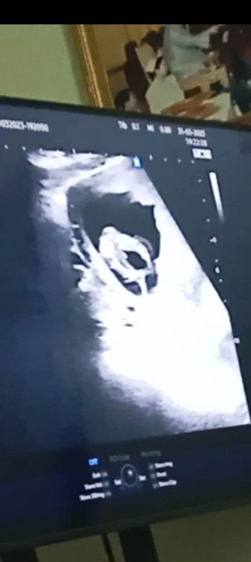 ซาวเพศแล้วหมอบอกว่าน่าจะเป็นผู้ชาย แบบนี้ผู้ชายไหมคะ 15w