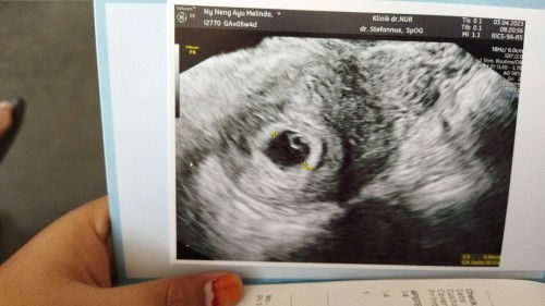 bersyukur alhamdulillah