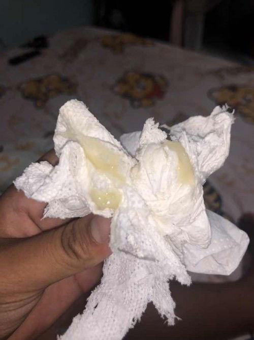 แบบนี้ใช่มูกมั้ยคะ