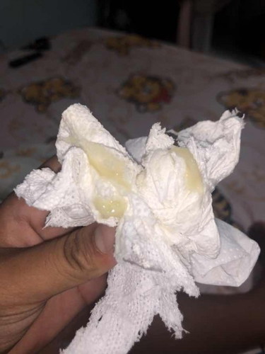 แบบนี้ใช่มูกมั้ยคะ