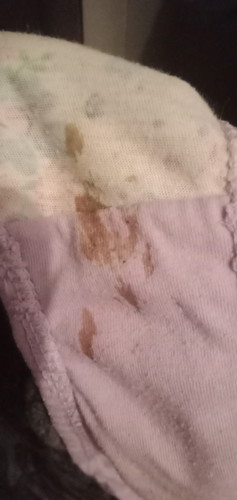 10 weeks pregnant with brown discharge