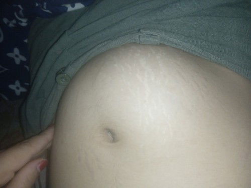 ท้องสอง ชอบโก่งตัว