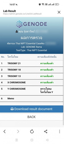 ผลดาวน์ซินโดรมเสี่ยงสูง