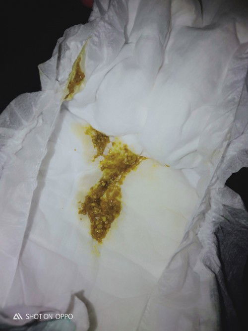 อุจจาระแบบนี้ปกติไหมค่ะ