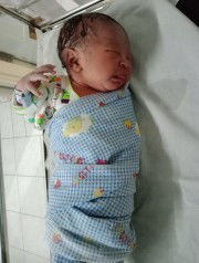 lahir 38w1d secara SC hpl 16 april