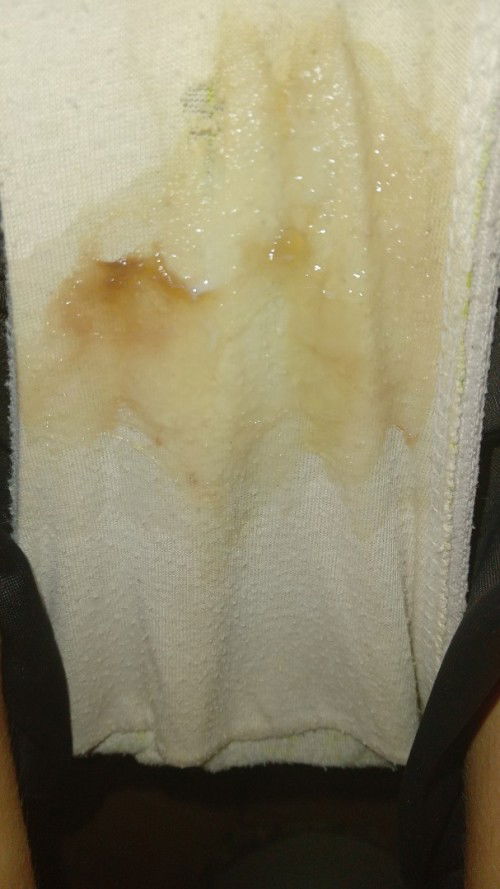 38weeks 3days napo ako 1cm parin po