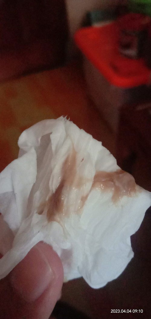 Apakah ini lendir darah?