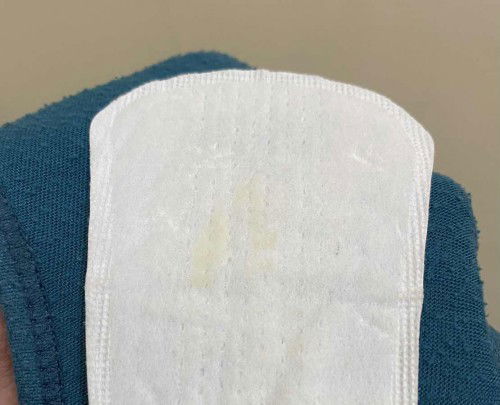 Flek kuning atau keputihan?