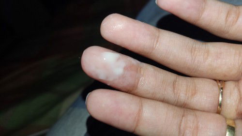 Seputar tanda² persalinan usia 36week