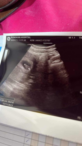 8สัปดาห์เจอน้องแล้ว