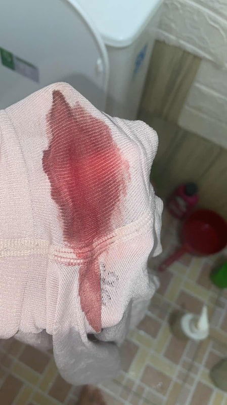 Trimester 2 tiba" keluar darah