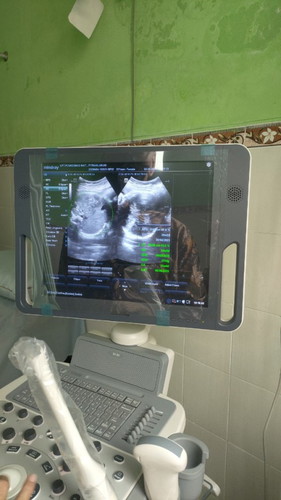 35 Minggu bbj 2.7