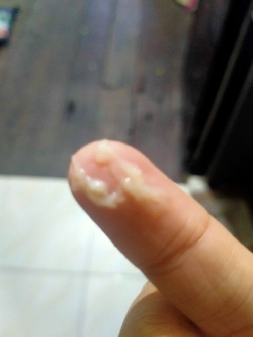 Hamil 19 minggu keluar keputihan seperti ini aman ngak ya bun ,keputihan nya ndk berbau