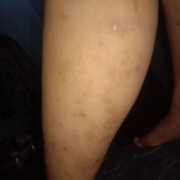 HORMON JANIN GATAL GATAL