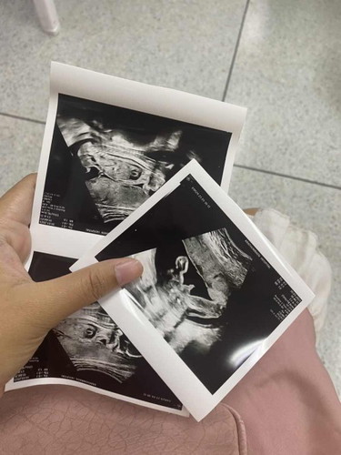 แม่ๆได้น้องเพศอะไรกันบ้างคะ