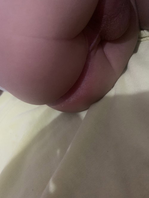 Bayi ruam popok atau jamur ya ini