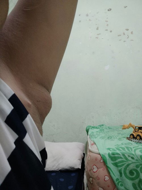 Ketiak bengkak dan sakit ketika di tekan