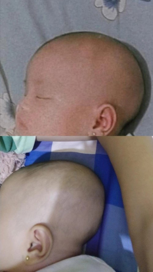Kepala bayi berubah