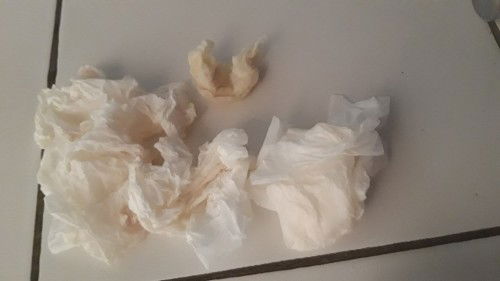 Hamil 5 bulan keluar air