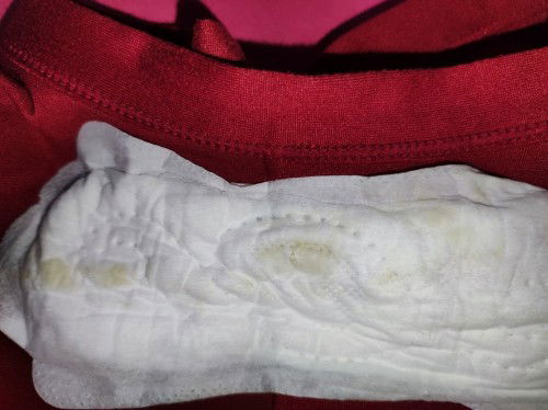 Keputihan Saat hamil 22 week