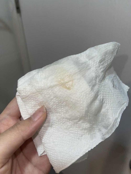 ผิดปกติมั้ยคะ ท้อง 6w