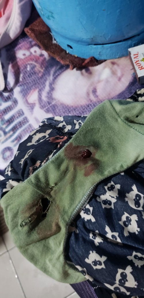 mucus plug na ba to?