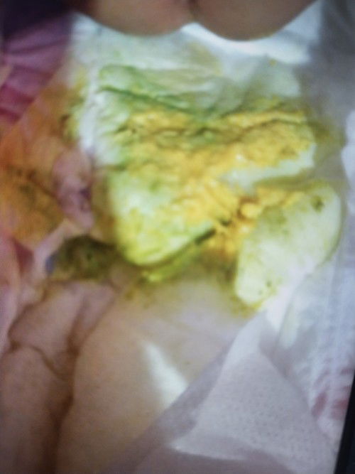 Bantu ksi saran n solusi