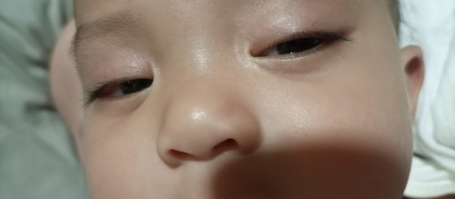 Naka dilat mata ni baby habang tulog